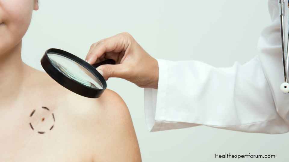 Health Expert Forum Insights: Skin Cancer prevention women